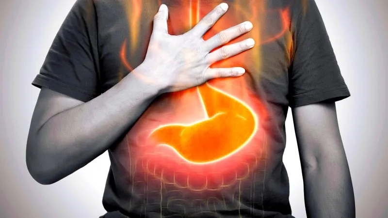 Do You Have Excess Stomach Acid? Acid reflex - GERD