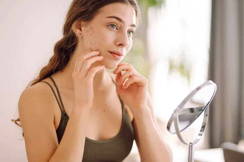 Banish Blemishes: Your Comprehensive Guide to Getting Rid of Acne